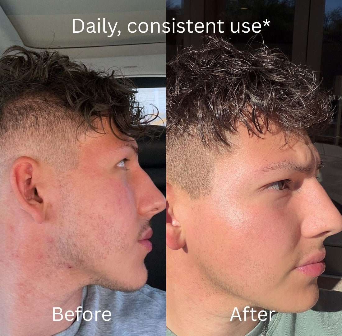 Grass-Fed Beef Tallow Moisturizer